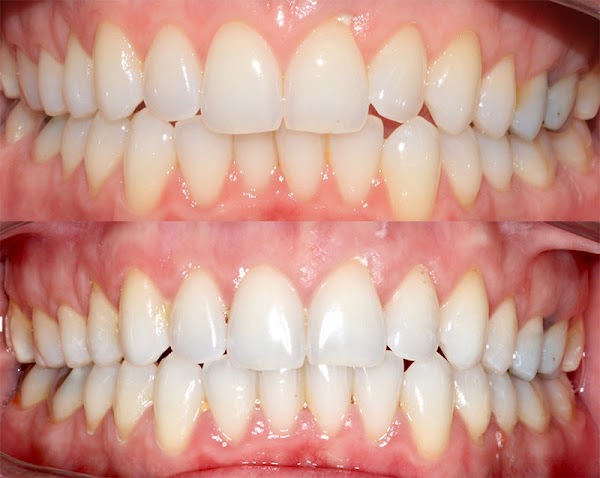 Dental Members Adelaide City