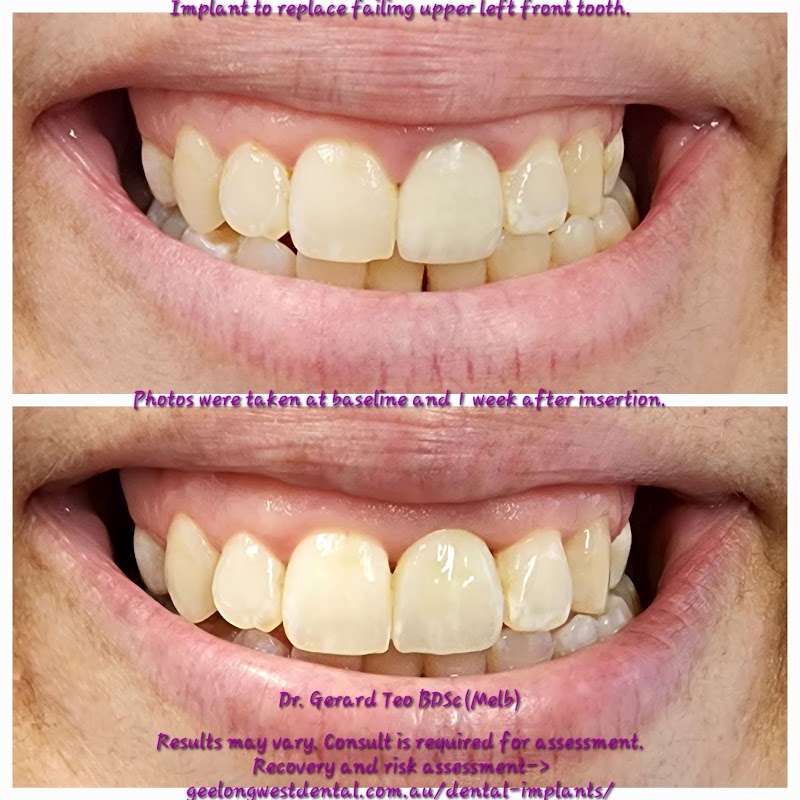 Geelong West Dental