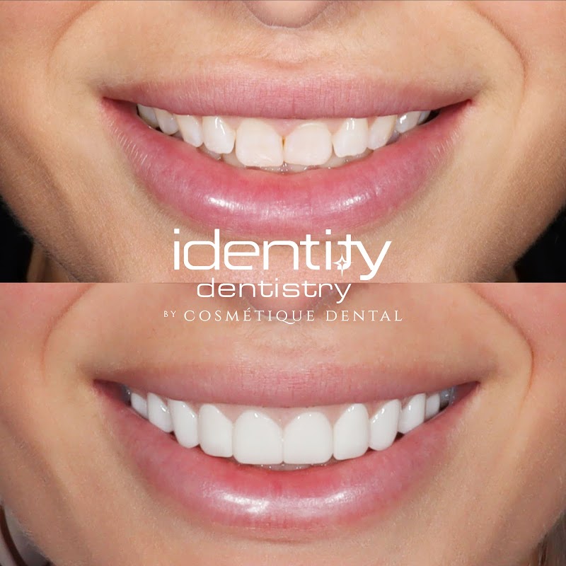 Identity Dentistry | Cosmetique Dental