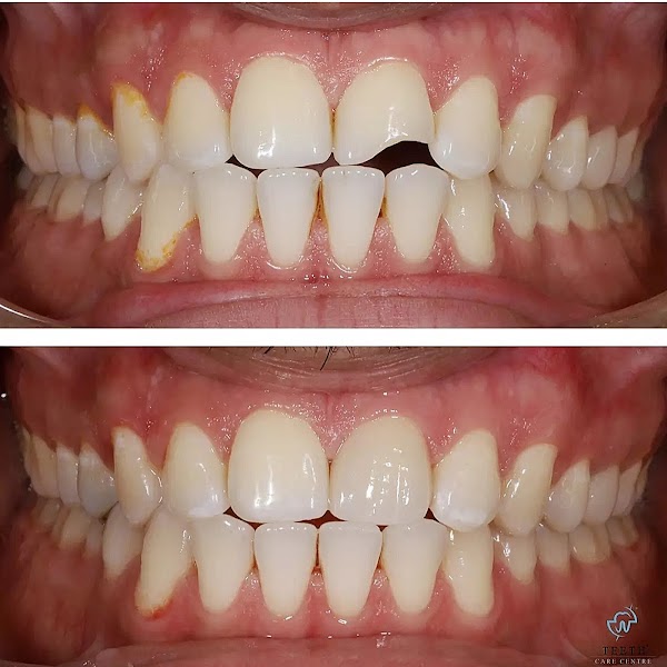 Teeth Care Centre® Dental Hospital [High-end Dentistry]